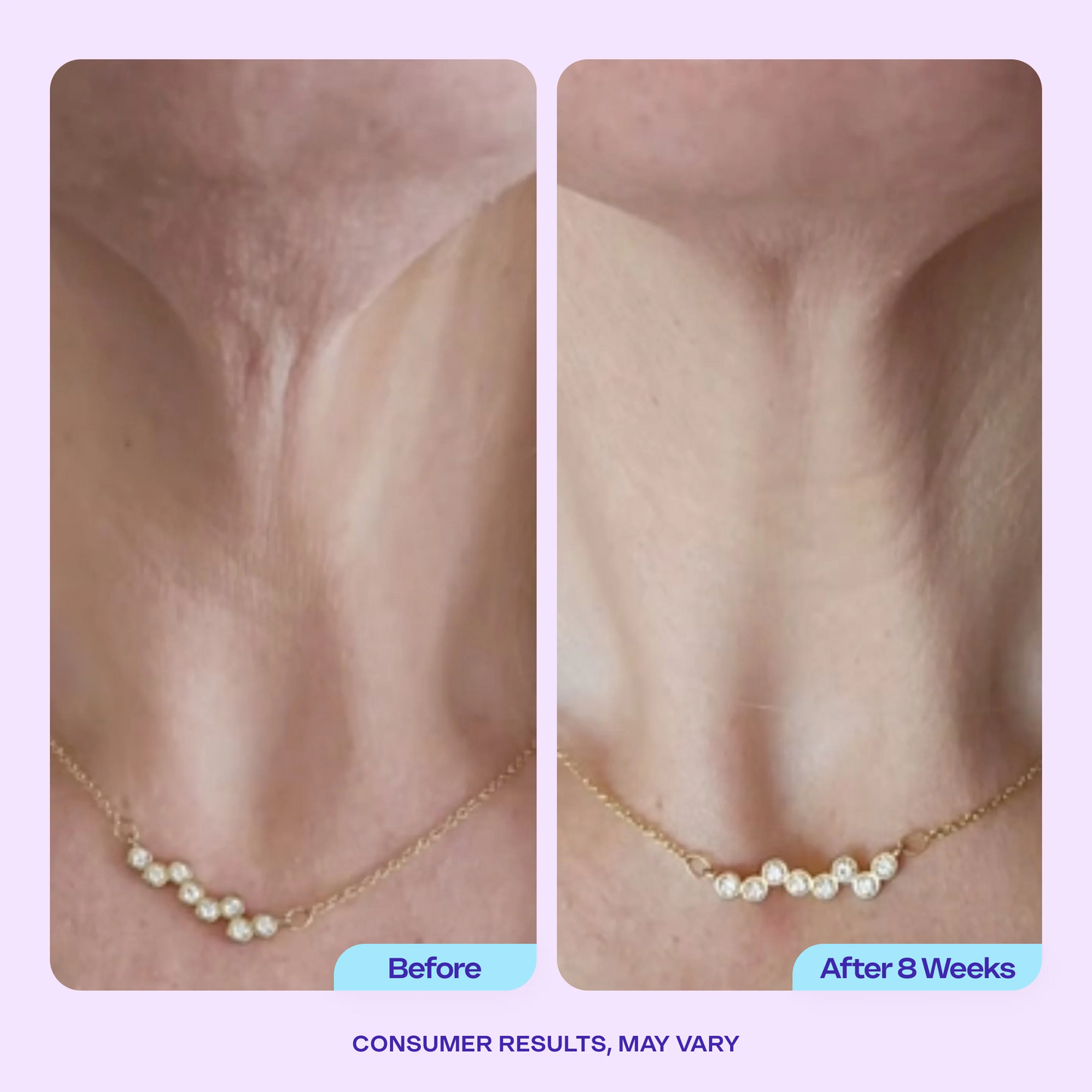 Tighten & Lift Neck Cream